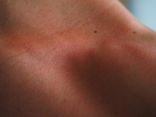 Jak propolis radzi sobie z chorobami skóry